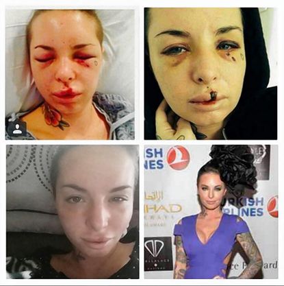 SEE IT: Christy Mack, porn star beaten by boyfriend, makes first public  appearance - New York Daily News