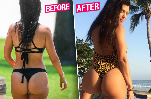 Kourtney Kardashian Photoshops Naked Butt: An Expert's Claims