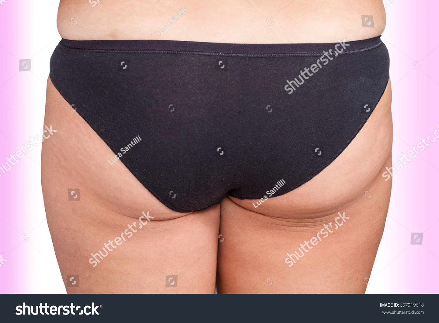 Fat Ass Woman Cellulite : стоковая фотография (редактировать ...