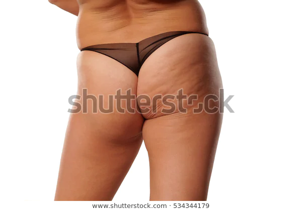 Fat Ass Woman Cellulite Stock Photo (Edit Now) 534344179