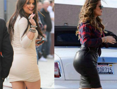 Khloe Kardashian Plastic Surgery: Morphing into Kim Kardashian