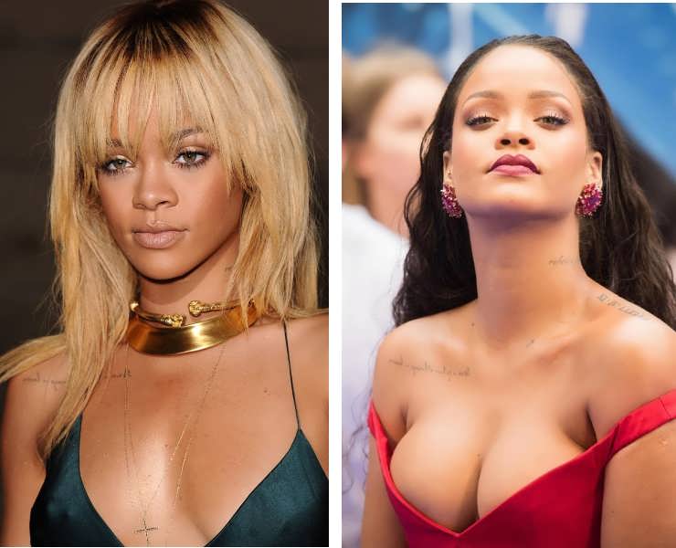 Has Rihanna Had Plastic Surgery? (Before&After Photos 2018)