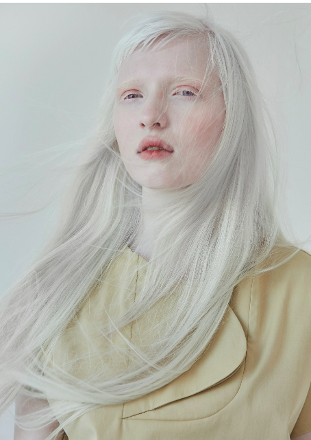 Nastya Zhidkova 2019-02-27 | Albinism, Albino, White blonde hair