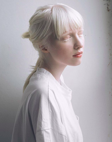 Albino model Nastya Zhidkova - Album on Imgur