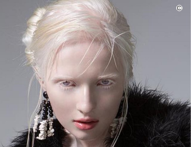 Nastya Zhidkova (Beautiful Russian Albino Model) â€” Steemit