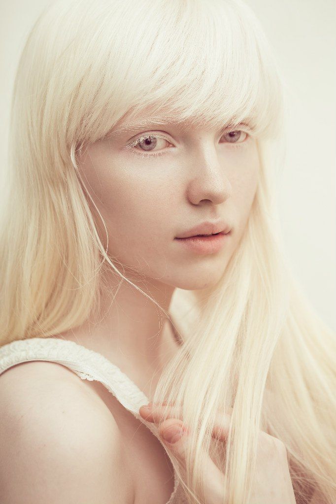 nastya zhidkova | Tumblr | Albino girl, Albino model, Portrait