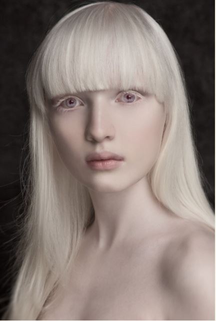 Meet Nastya Zhidkova, The Most Beautiful Albino Girl In The ...