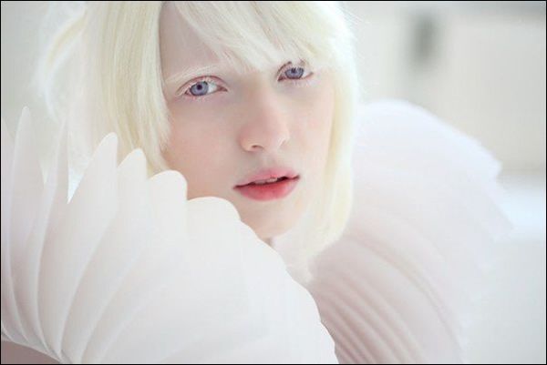 This Is Nastya Zhidkova, A Model With Albinism Who Is Taking ...