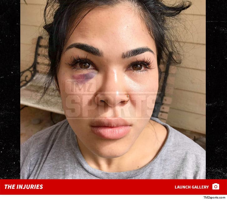 Rachael Ostovich Attack Video Surfaces, 'I'm Going to F ...