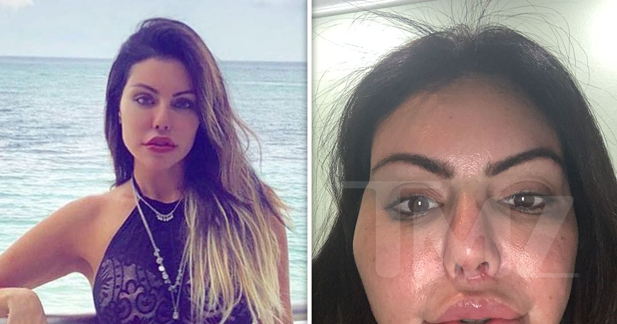 Liziane Gutierrez Suffers Face Swell After Another Botched ...