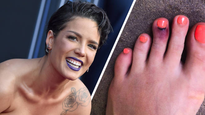 Halsey breaks her toe trying to save a butterfly - Capital