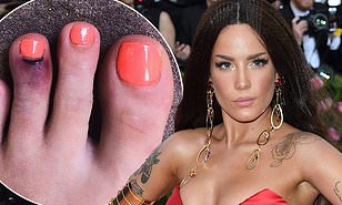 Halsey breaks her toe while trying to save an injured ...