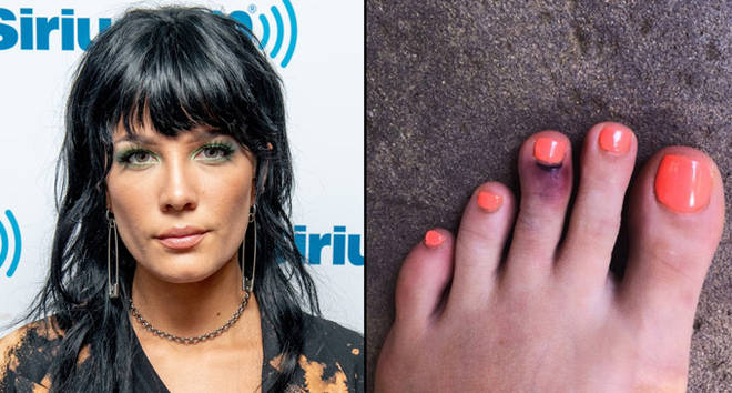 Halsey broke her toe trying to save a butterfly and it looks ...