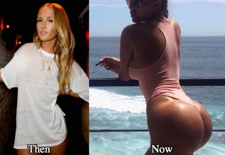 Niykee Heaton Surgery: Learn all the Intricate Details of the ...