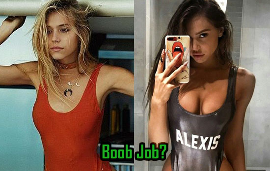 Alexis Ren Plastic Surgery, Boob Job, Lips Injection, Before After ...