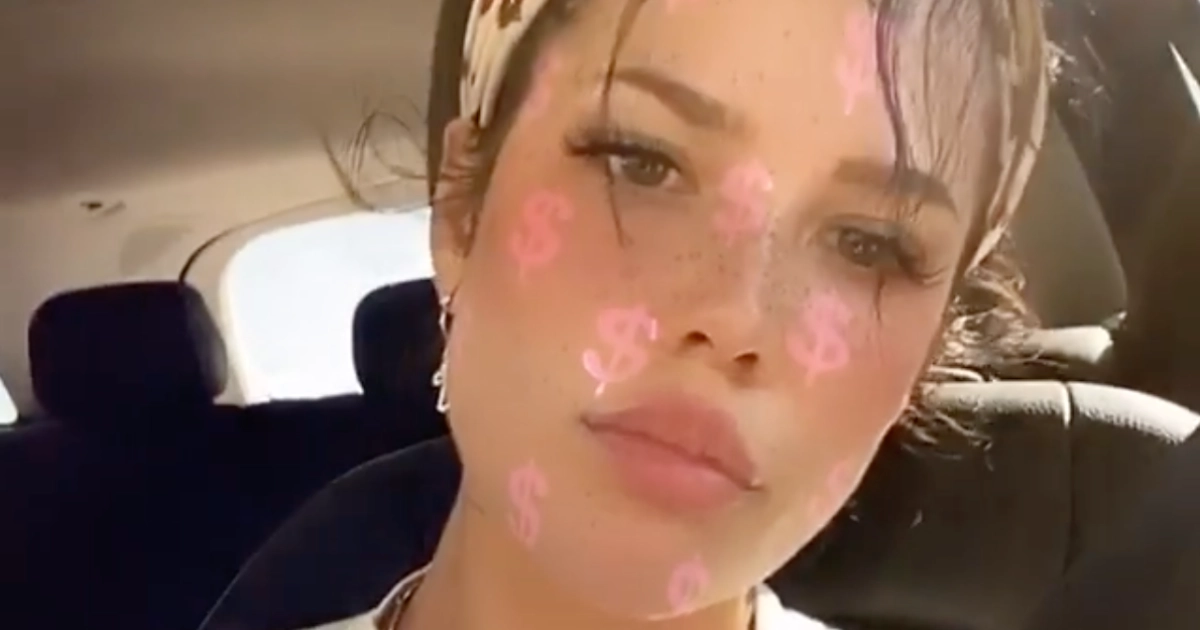 Halsey Slams Plastic Surgery Comments After Using Instagram Filter