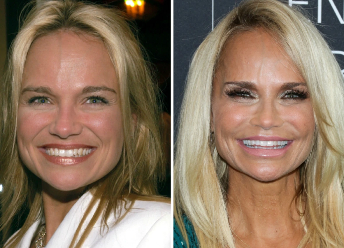 Did Kristin Chenoweth Get Plastic Surgery? Experts Weigh In (EXCLUSIVE)
