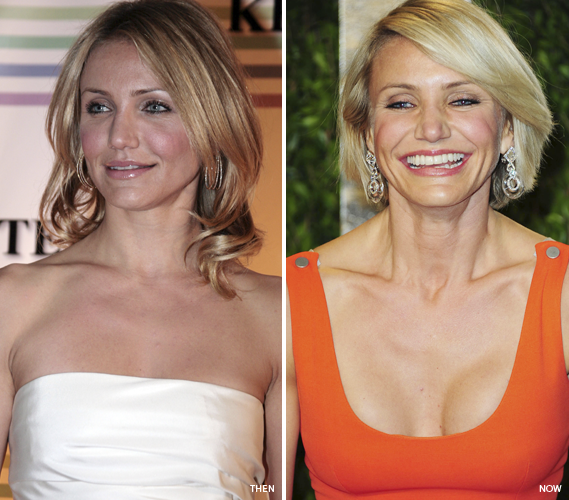 Celebrity Breasts: Fake Or Fashion-Taped? - NewBeauty